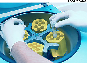 É válida cláusula de plano de saúde que exclui fertilização in vitro