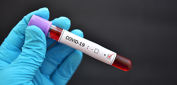 JT destina R$ 160 milhões de indenizações à prevenção da Covid-19